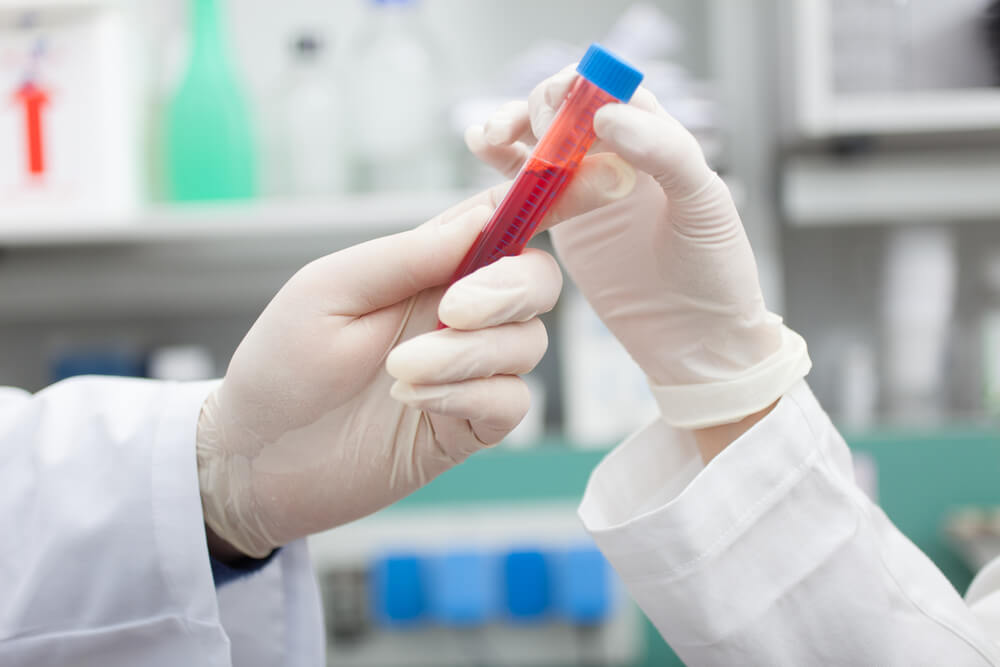 duas mãos com luvas seguram uma ampola de exame de sangue (sorologia). Essa imagem é uma das que ilustram o post sobre o que são anticorpos.