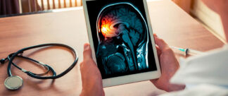 Meningite: como se prevenir dessa doença?