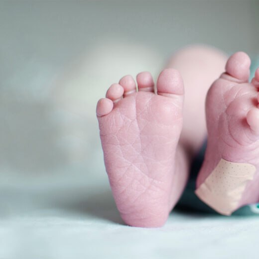 Exame do teste do pezinho feito no bebê