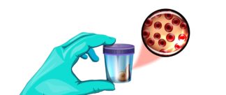 Como fazer exame de fezes: dicas para um diagnóstico de sucesso