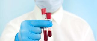 Quais são os tipos de exame de sangue mais solicitados e como se preparar para a testagem?