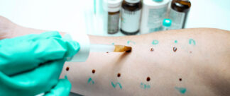 Alergia a medicamentos: sintomas e como tratar