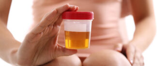 Como fazer exame de urina: do preparo até a entrega no laboratório