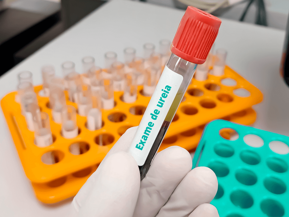 Mão com luva segurando uma ampola de sangue com amostra para o exame de ureia