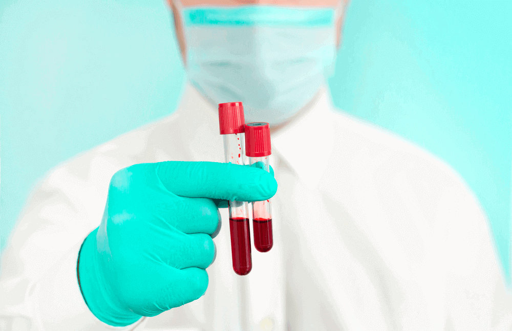 um médico de luvas verdes segurando 2 tubos de ensaio com amostras de sangue. - glicemia em jejum