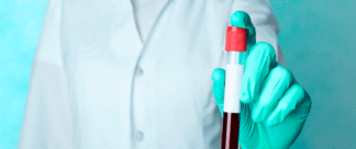 Exame NIPT: para que serve?