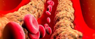 O que são Triglicerídeos e como evitar problemas?