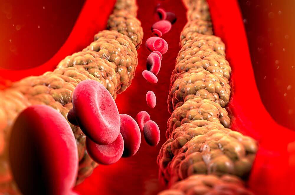 Corrente sanguínea mostrando as gorduras do corpo e o que é triglicerídeos