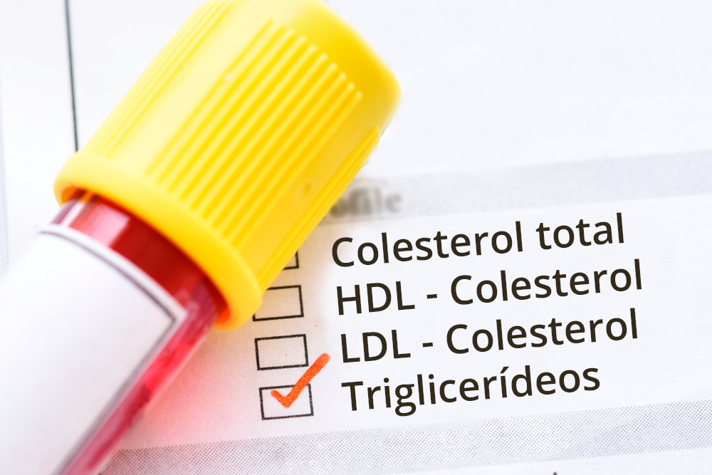 um tubo de ensaio em cima de um papel mostrando índices de exames de sangue - triglicerideos exame