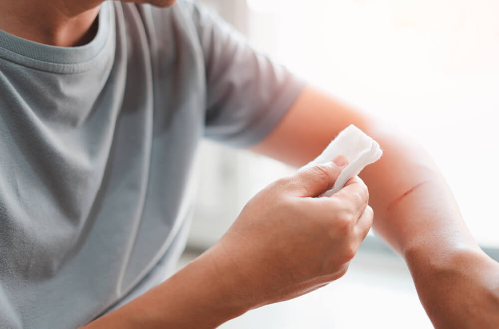 Imagem mostra uma pessoa colocando curativo no braço para tratar o ferimento, uma das principais formas da bactéria entrar no organismo e desencadear os sintomas do tétano