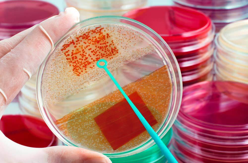 analise clinica de bactérias, representando a meningite bacteriana