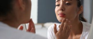 O que é herpes: sintomas, diagnóstico e tratamento