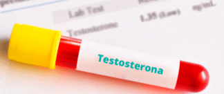 Exame de Testosterona: o que é e como fazer?