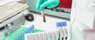 Exame FAN: o que o fator antinuclear pode indicar?