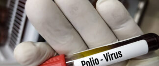 O que é poliomielite: veja as 8 principais dúvidas sobre a doença