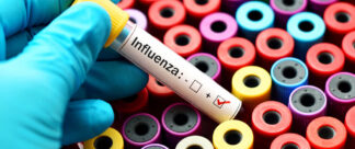 Qual exame fazer para diagnosticar o vírus influenza?