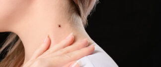 Febre maculosa: o que é, sintomas e tratamento