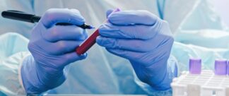 Exame de ferritina: valores de referência e muito mais!