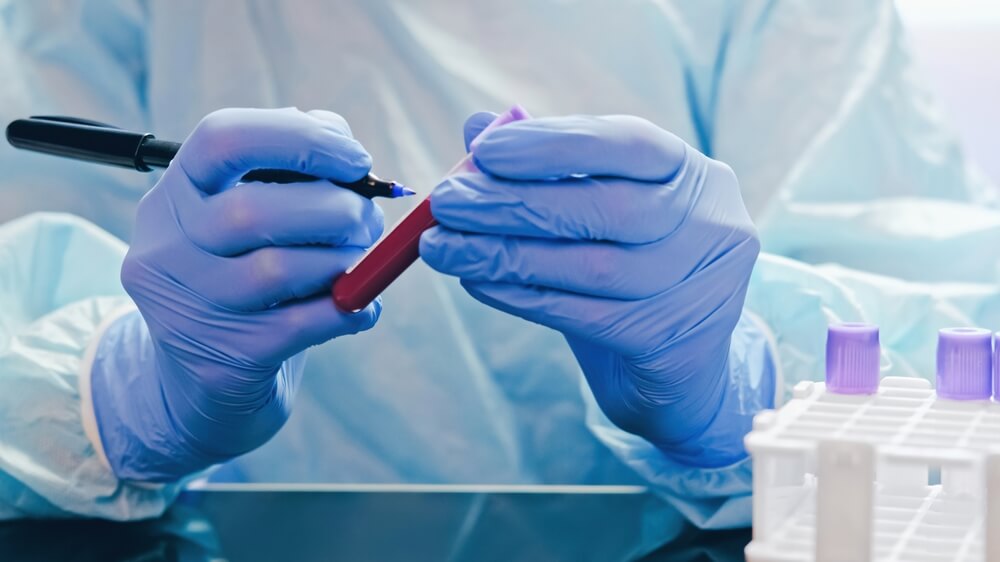 Técnico no laboratório analisando uma amostra do exame de ferritina